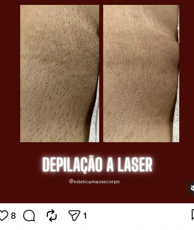 Registro de resultado de protocolo corporal