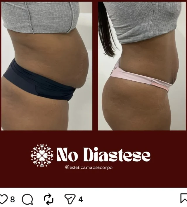 Registro de cuidado abdominal