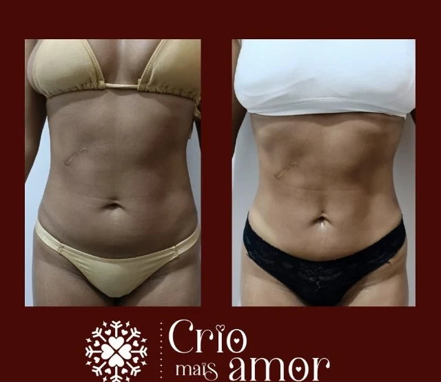 Registro de tratamento facial