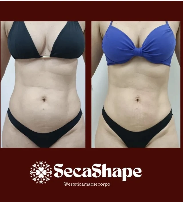 Registro de protocolo SecaShape